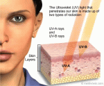 UV-radiation