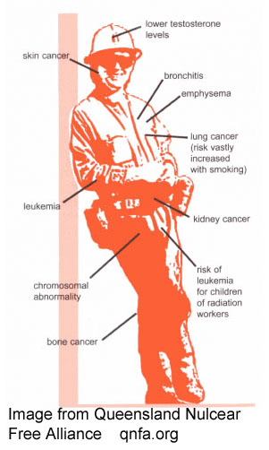 health-uranium-worker